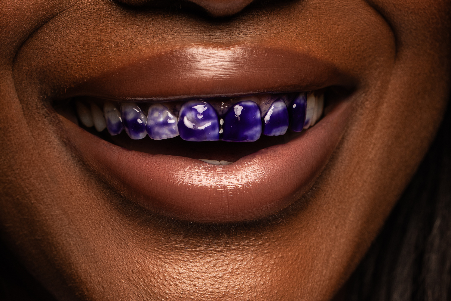 V34 & PAP+ Lápiz Blanqueador